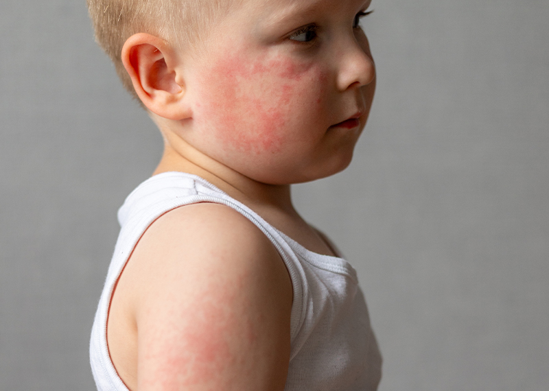 dermatologia