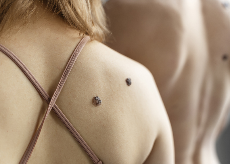 dermatologia