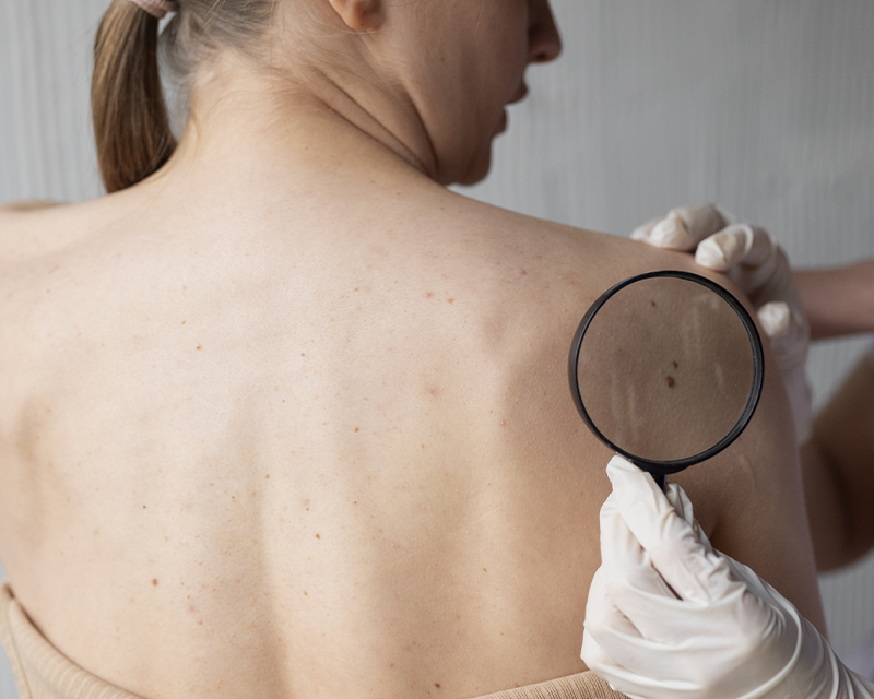 Dermatologo durante il controllo dei nei e della pelle presso Rinnova Medical a Nova Milanese.